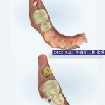 郑州种植牙医生高功杰