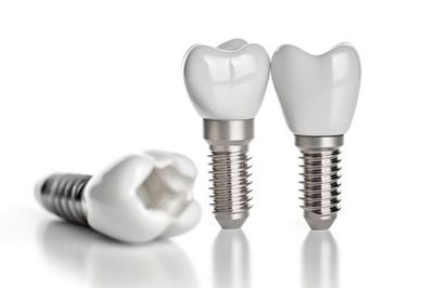 郑州种植牙5折丨牙齿缺几颗种几颗?植得口腔医生这么解释!