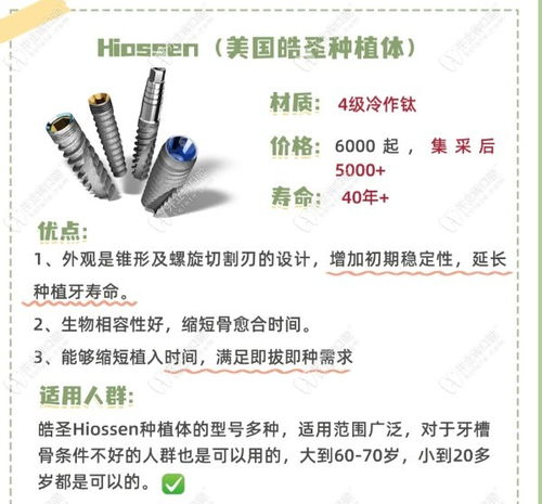 韩国仕诺康和美国皓圣种植牙哪个好 hiossen材质好寿命长些