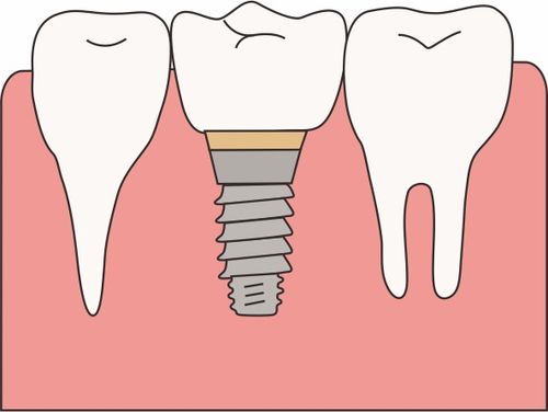 牙医提醒 一刷就能长新牙的牙膏不可信