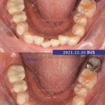 郑州种植牙医生高功杰