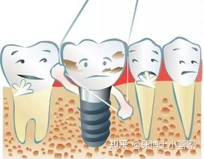 郑州哪家医院种植牙做得好?