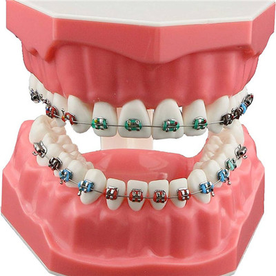 盘点郑州中诺口腔种植牙价格!详解中诺种植牙贵吗?