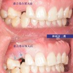郑州种植牙专家高功杰 专业技术守护口腔健康