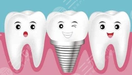 郑州种植牙价格表一览！2025爱牙指南分享